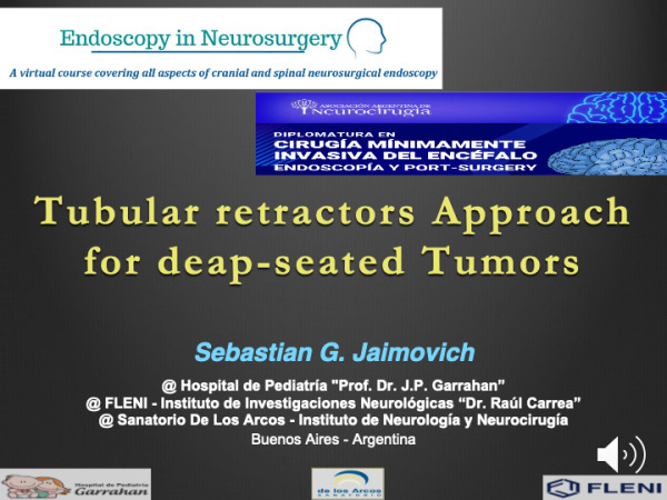 Tubular Retractors Approach For Deap-Seated Tumors