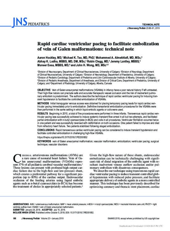 Rapid cardiac ventricular pacing to facilitate embolization of vein of Galen malformations: technical note