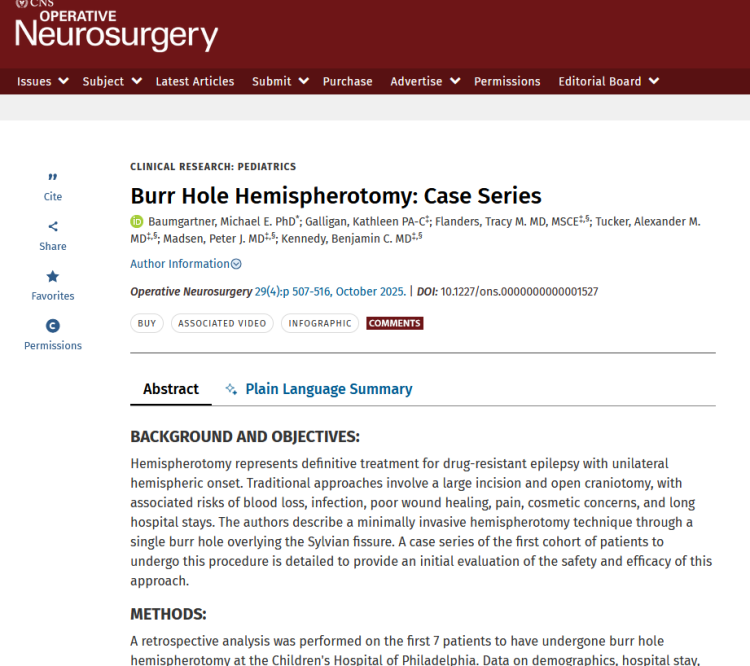 Burr Hole Hemispherotomy: Case Series