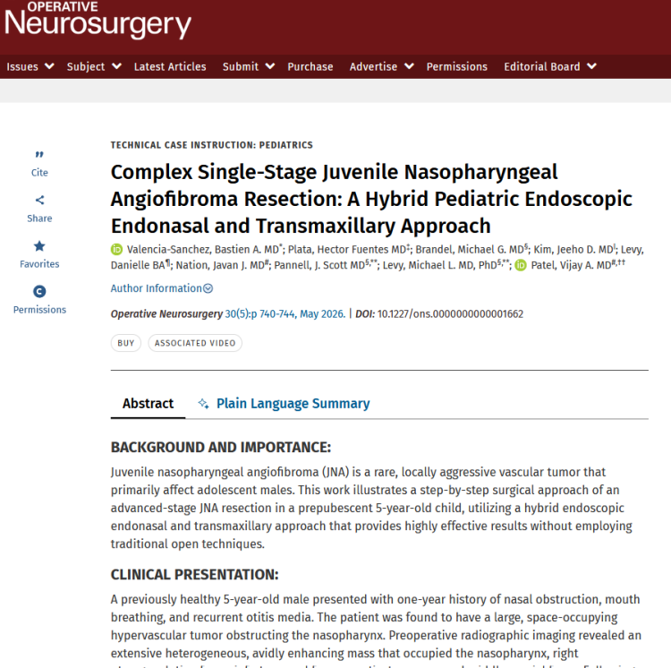 Complex Single-Stage Juvenile Nasopharyngeal Angiofibroma Resection: A Hybrid Pediatric Endoscopic Endonasal and Transmaxillary Approach